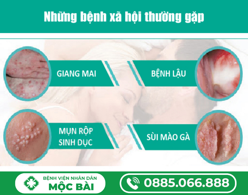 TÌM HIỂU BỆNH XÃ HỘI LÀ GÌ?